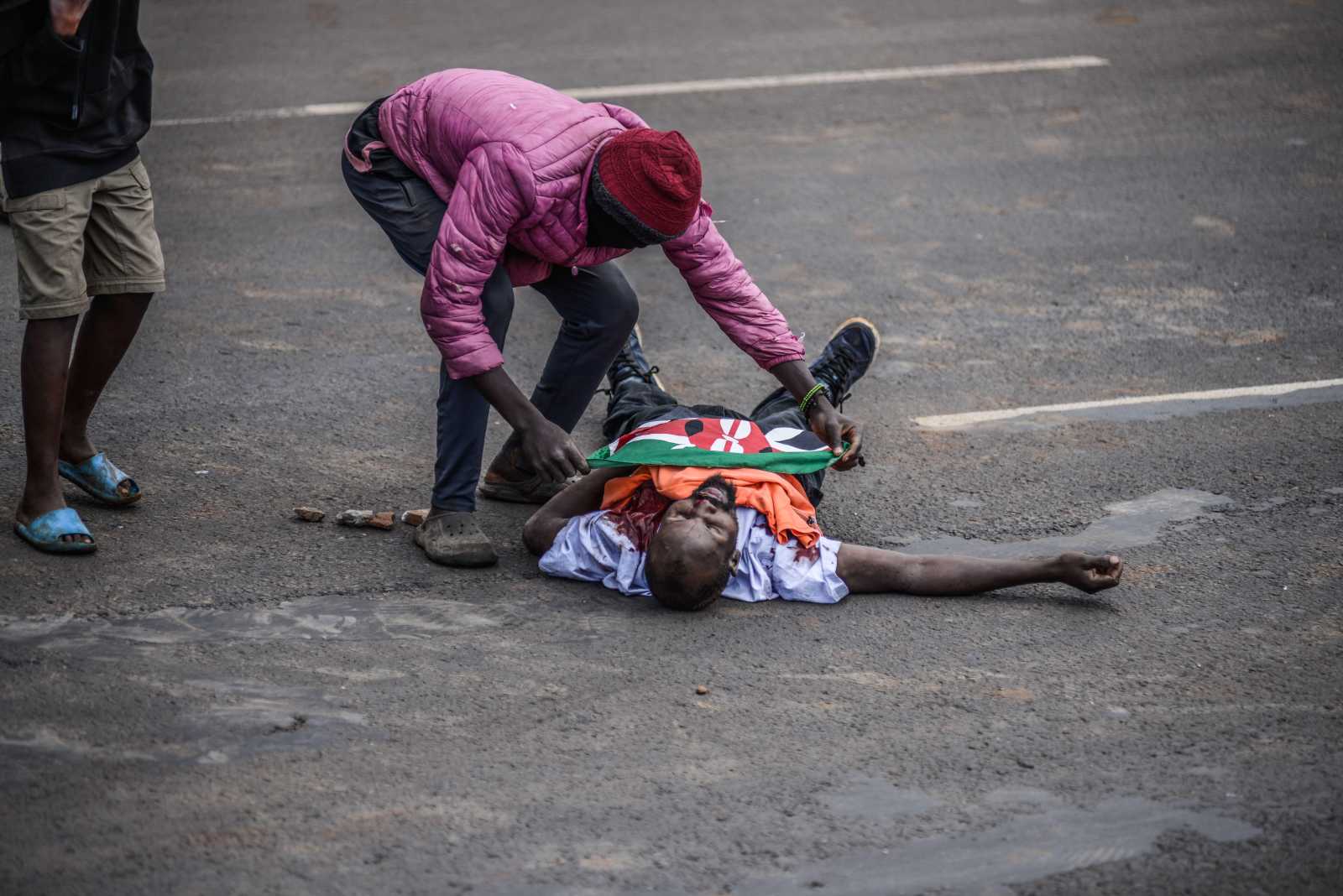 Eine von vielen schwer verletzten Personen während der Saba-Saba-Proteste.