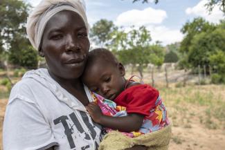 This baby girl from Zimbabwe is undernourished because her parents lack food.